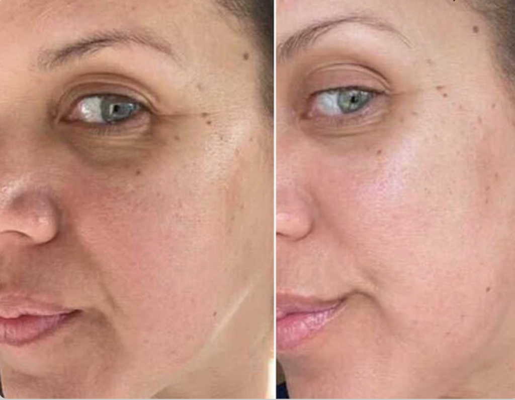 vitamin c serum vs retinol for wrinkles